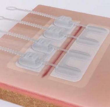 Bandaż Zipstitch, który pozwala zabezpieczyć ranę bez konieczności zakładania szwów